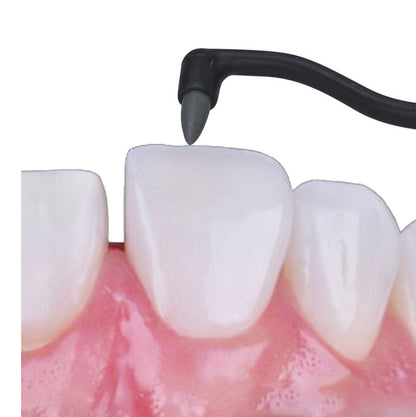 Acoustic Tooth Cleaner Tooth Stone Remover
