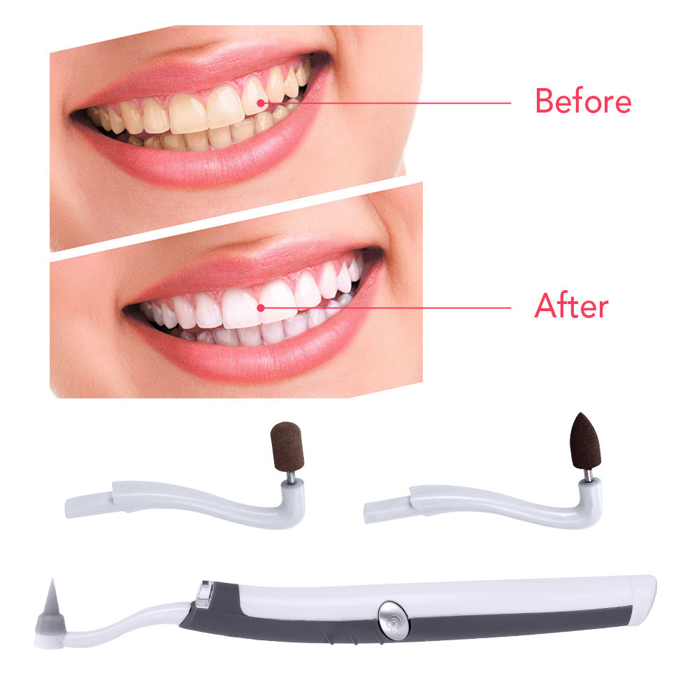 LED Electric Sonic Pic Tooth Stain Eraser