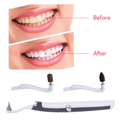 LED Electric Sonic Pic Tooth Stain Eraser